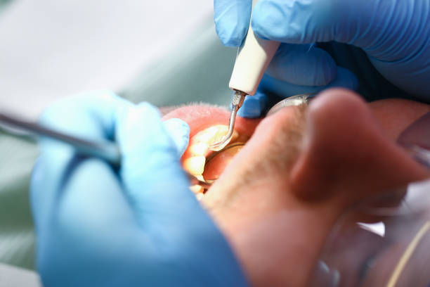 Best Chipped Tooth Repair Near Me  in Prestonsburg, KY