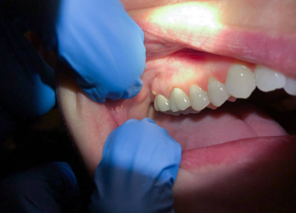 Best Cracked Tooth Emergency Dentist  in Prestonsburg, KY